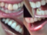 【お得なSET販売】綺麗なお姉さまのお口事情[20060100]